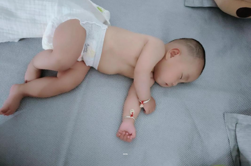 郑州宝宝脸上有白色斑块